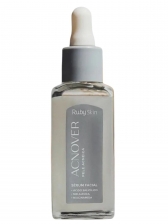 Sérum Facial Antiacne Acnover Ruby Rose 30ml