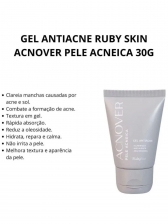Gel Antiacne Acnover Ruby Rose 30g